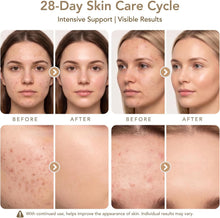 Load image into Gallery viewer, Dr. pen M9 Microneedling Pen