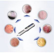 Load image into Gallery viewer, Kernel 311nm UVB Narrowband Phototherapy Lamp