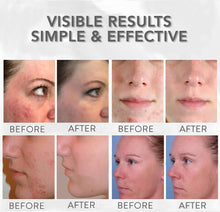 Load image into Gallery viewer, Angel Kiss 7 Color LED Light Therapy Mask