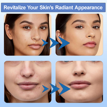 Load image into Gallery viewer, Angel Kiss M8 Pro Professiona Microneedling Pen - Wireless Derma Pen Beauty Pen
