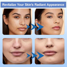 Load image into Gallery viewer, Dr.pen Ultima M8 / M7S Microneedling Pen Original Cartridges, Compatible with Angel Kiss M8 PRO,10Pcs / Pack
