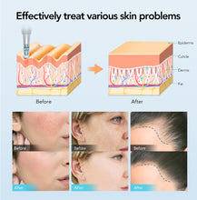 Load image into Gallery viewer, Dr. Pen M7S Microneedling Pen Derma-Pen - with 6 Cartridges
