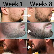 Load image into Gallery viewer, 540 Microneedling Beard Roller - Titanium Needles
